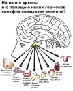 Опухоли гипофиза: симптомы и диагностика