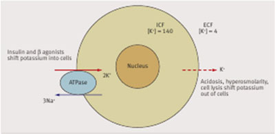 hyperkalemia2.jpg