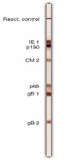 immunoblotting.jpg